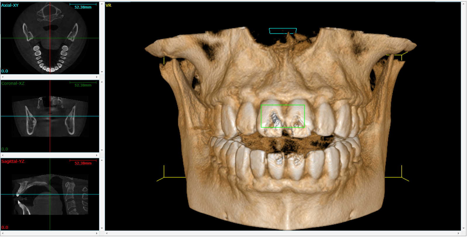 Cone Beam 3D Imaging  Lynden, WA 