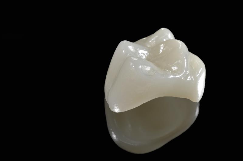 Porcelain Crowns Lynden, WA